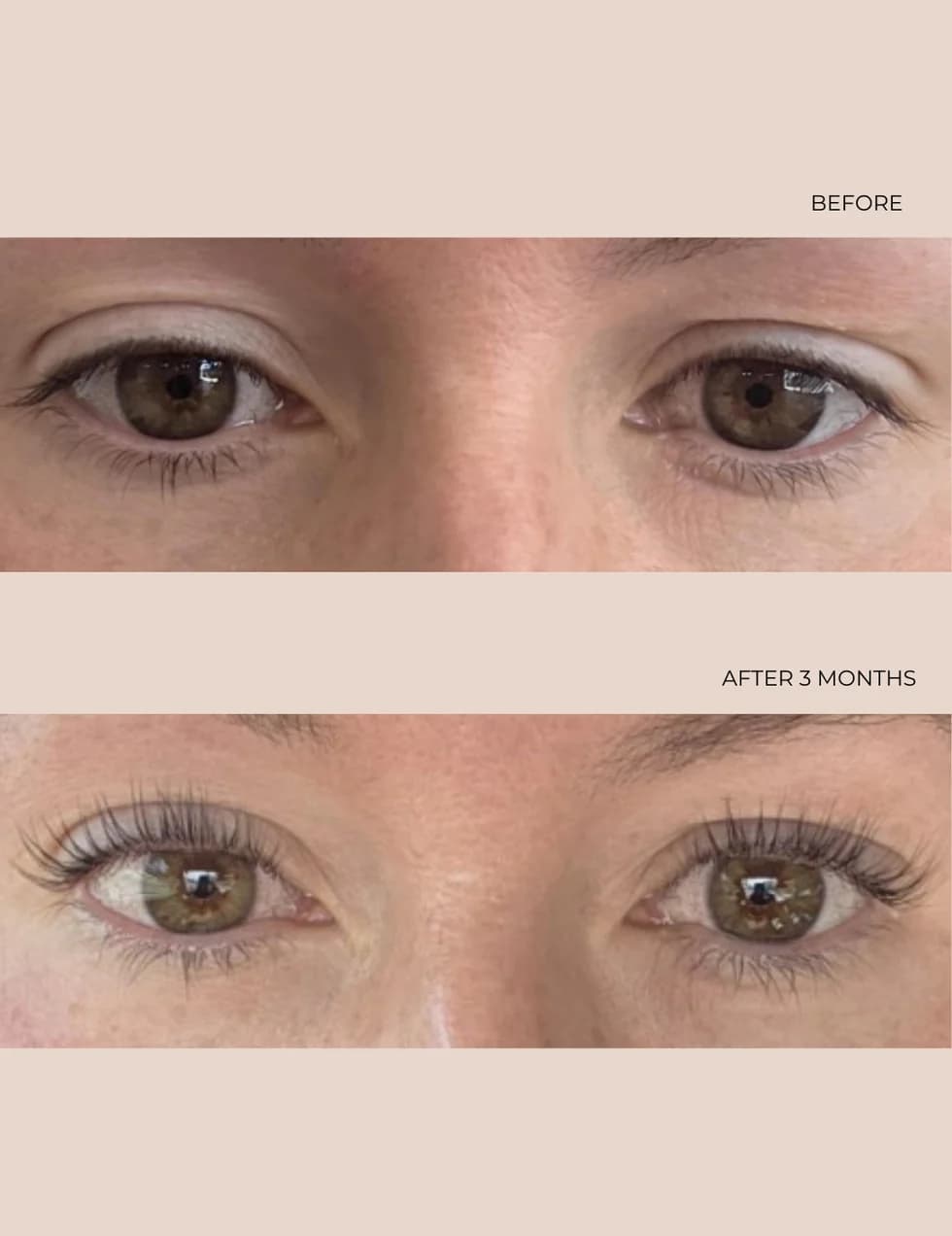 before after   last serum